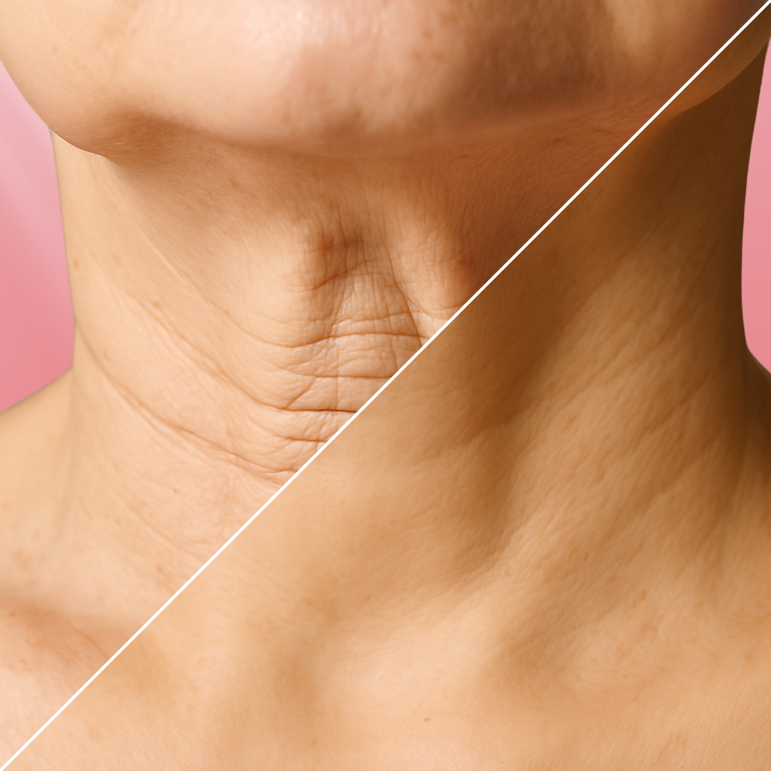 Résultat avant/après d’une cure de patchs Lunaya